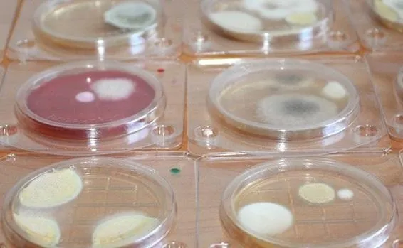 микробиологические экспресс-тесты  в Саратове 4