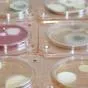 микробиологические экспресс-тесты  в Саратове 4